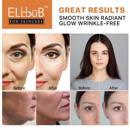 Premium 20% Vitamin C Serum for Face with Hyaluronic Acid, Retinol & Amino Acids - Boost Skin Collagen,Hydrate & Plump Skin, anti Aging & Wrinkle Facial Serum