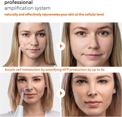 Nuderma Professional Skin Therapy Wand - Portable Device with 6 Neon and Argon Wands for Enhanced Skin Clarity, Firmness, and Tightening