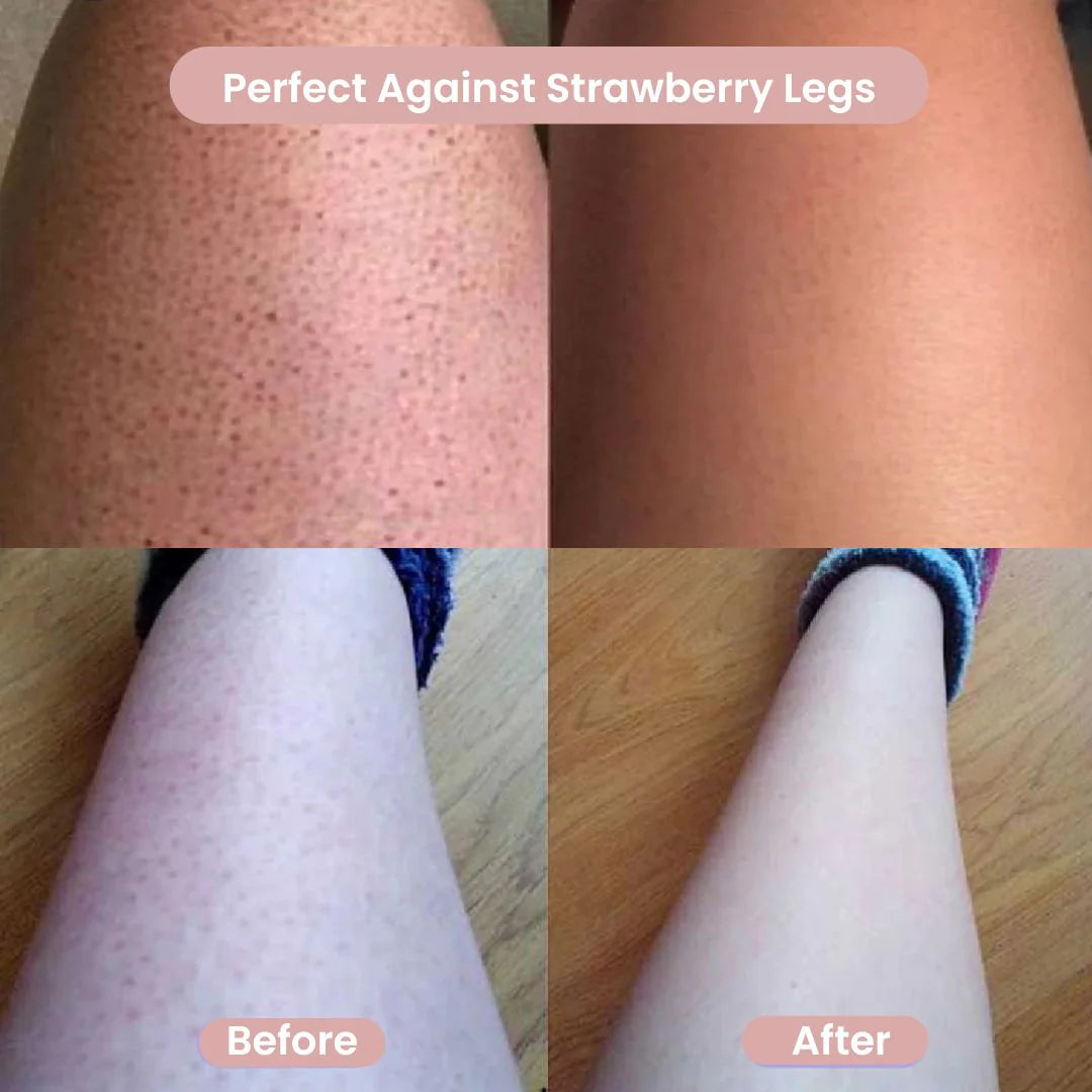 Women’s Precision Body Shaver – Safe, Smooth Grooming