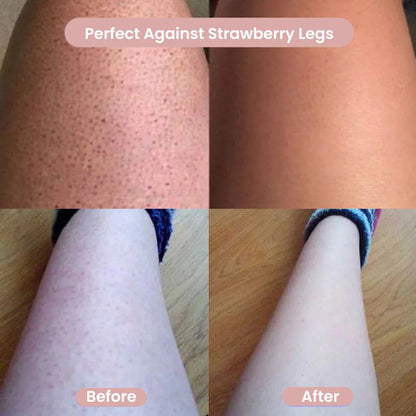 Women’s Precision Body Shaver – Safe, Smooth Grooming